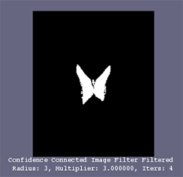 confidenceConnected4Iters