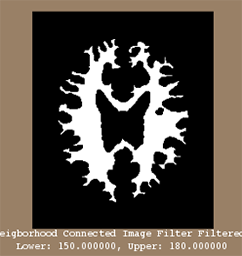 neighbourhoodConnectedFiltered